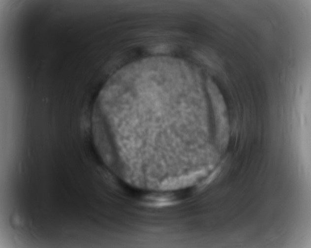 X0000087620179200705252010