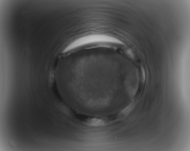 X0000087620180200705252010