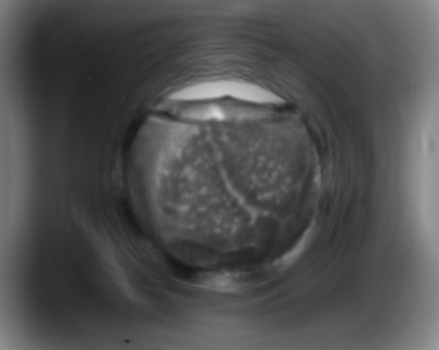 X0000087620182200705252010