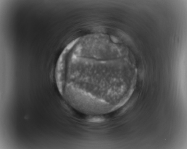 X0000087620185200705252010