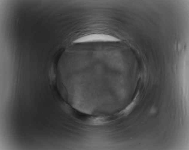 X0000087620186200705252010