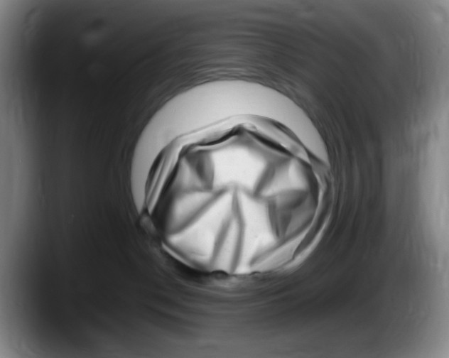 X0000087620190200705252010