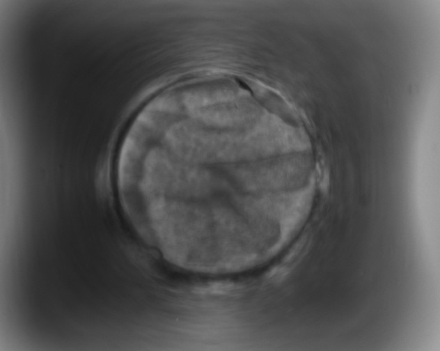 X0000087620196200705252009
