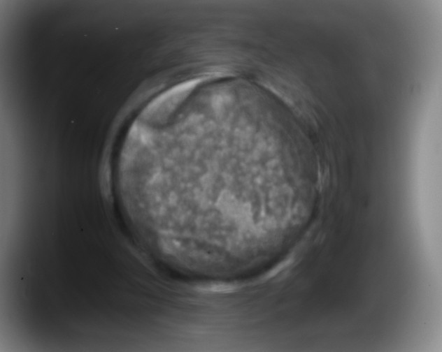 X0000087620198200705252009