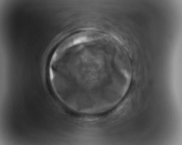 X0000087620199200705252009