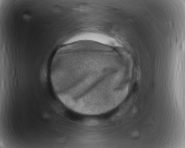 X0000087620207200705252009