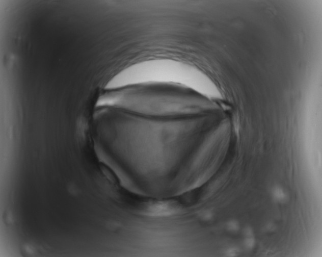 X0000087620235200705252009