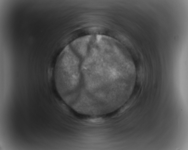 X0000087620278200705252009