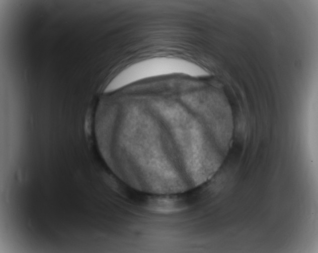 X0000087620282200705252009