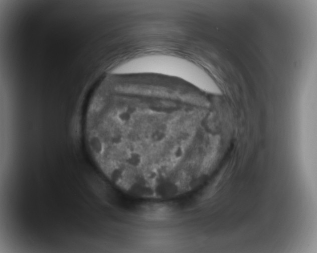 X0000087620299200705252008