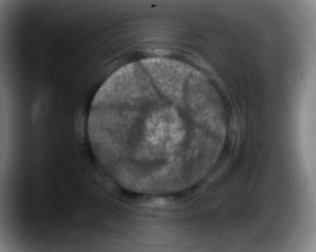 X0000087620330200705252008