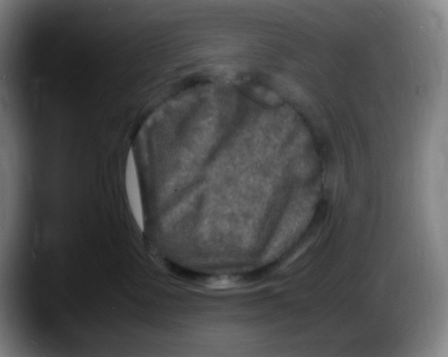 X0000087620335200705252007