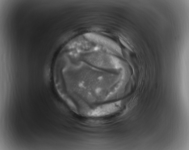 X0000087620351200705252007