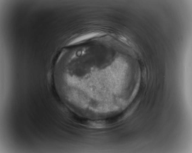 X0000087620359200705252007