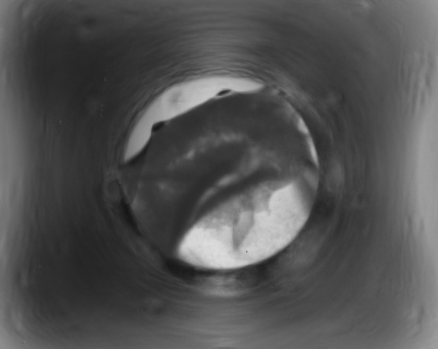 X0000087620366200705252007