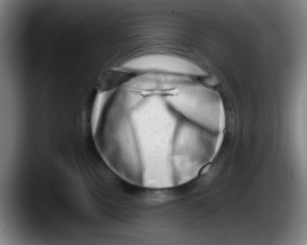 X0000087620378200705252007
