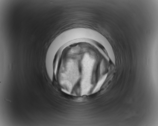 X0000087620382200705252007