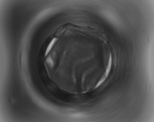X0000087620383200705252007