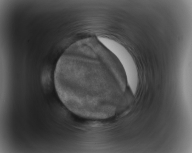 X0000087620424200705252006