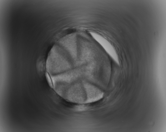X0000087620425200705252006