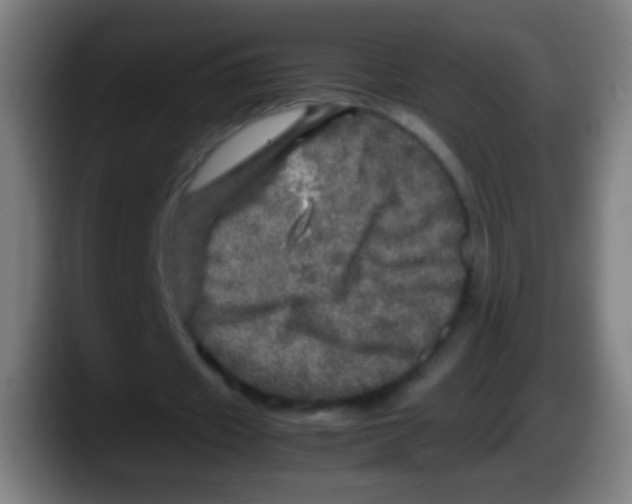 X0000087620433200705252005