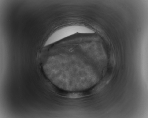 X0000087620461200705252006