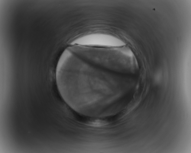 X0000087620467200705252006