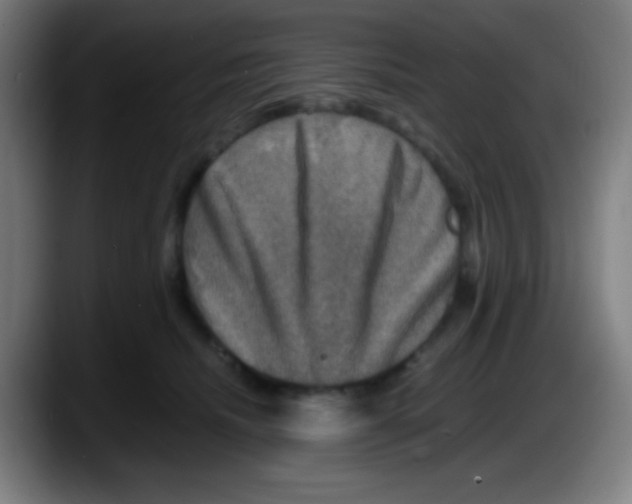 X0000087620468200705252006