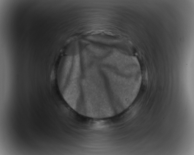 X0000087620472200705252006