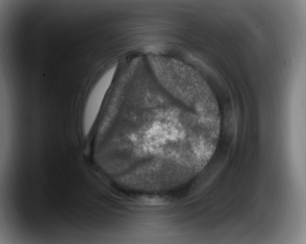 X0000087620502200705252005