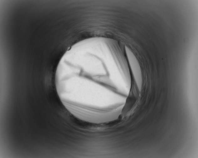 X0000087620514200705252005