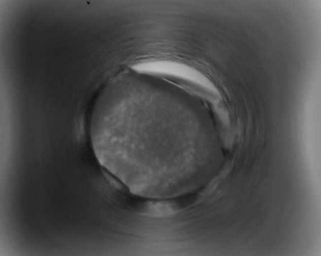 X0000087620520200705252005