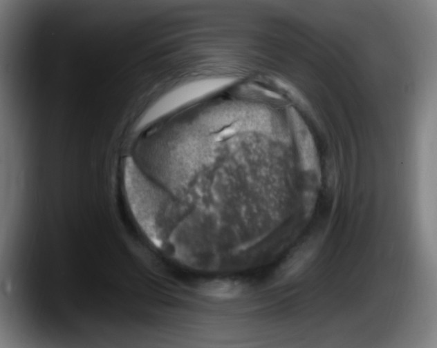 X0000087620542200705252004