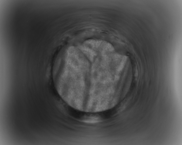 X0000087620559200705252005