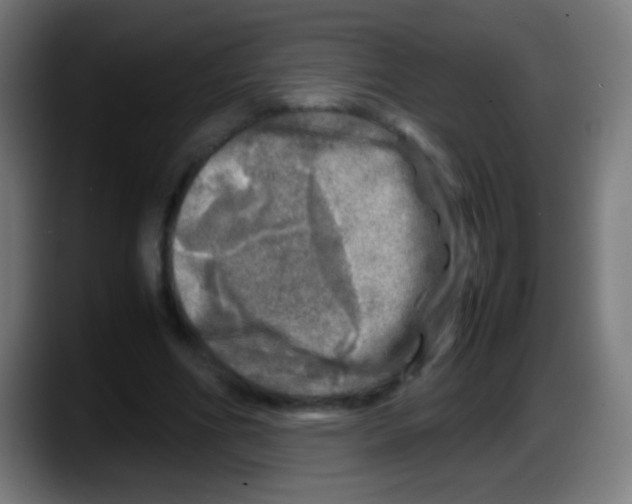X0000087620586200705252004