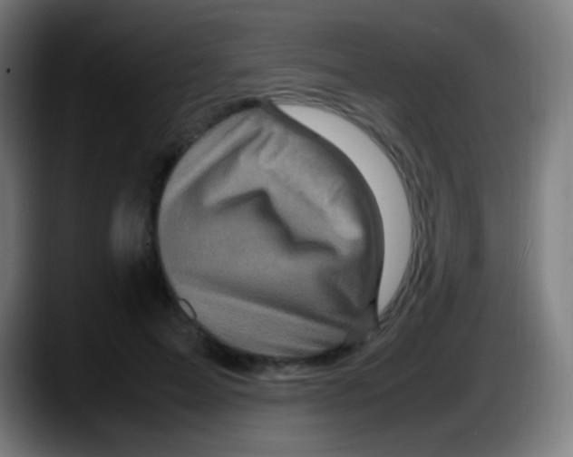X0000087620599200705252004