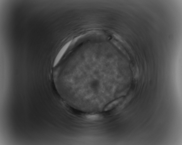 X0000087620669200705252004