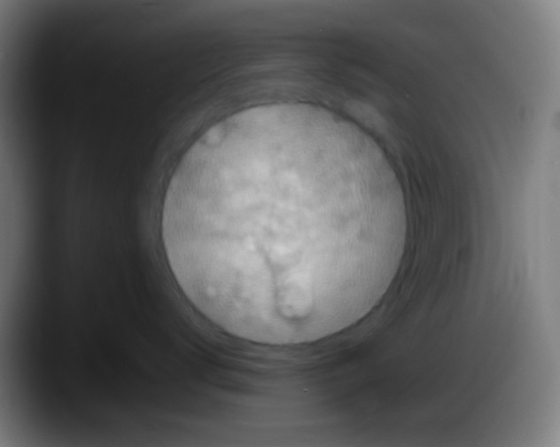 X0000087620672200705252004