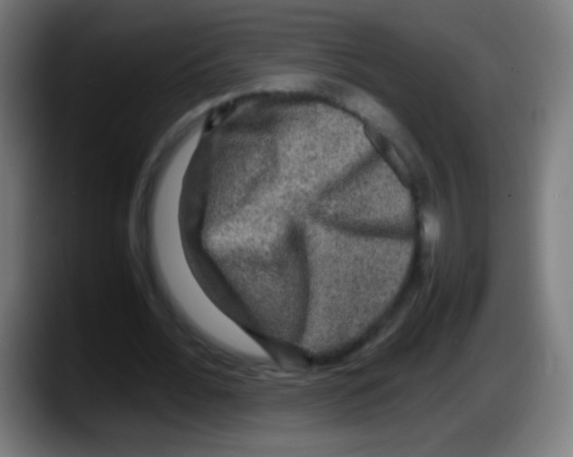 X0000087620676200705252003