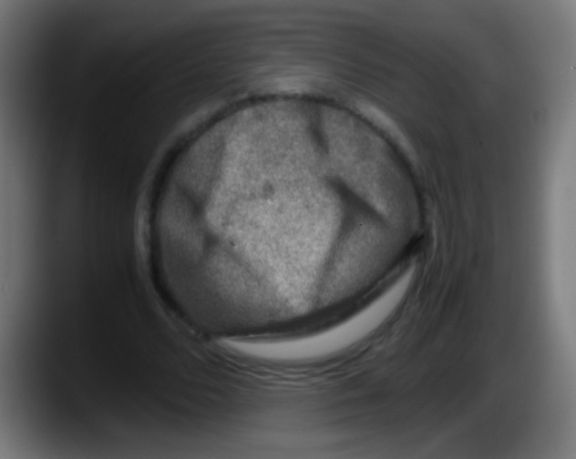 X0000087620680200705252003