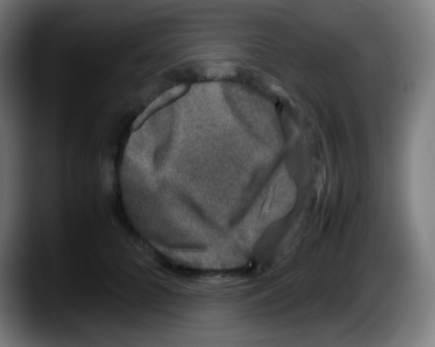 X0000087620704200705252003