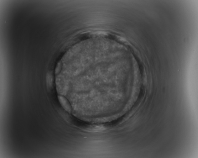 X0000087620715200705252002