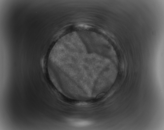 X0000087620759200705252002