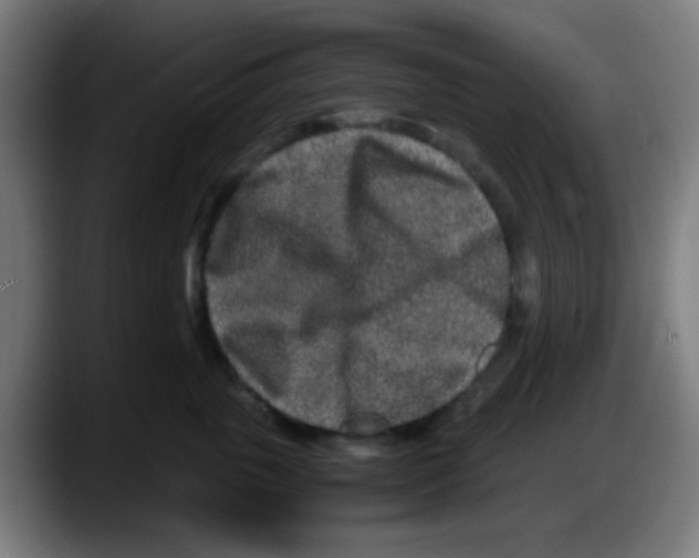 X0000087620763200705252002