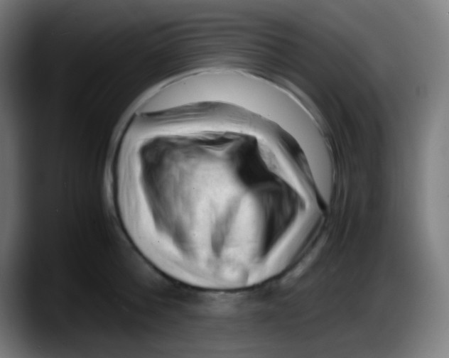 X0000087620812200705252001