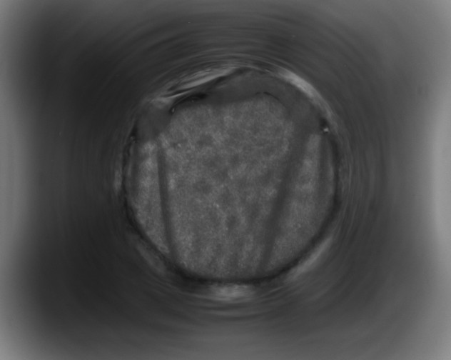 X0000087620833200705252001