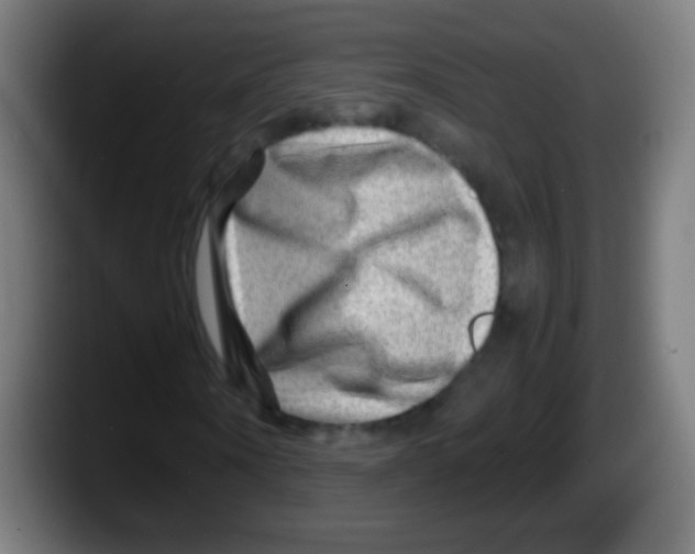 X0000087620866200705252000