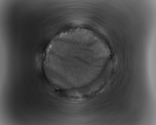X0000087620868200705252000