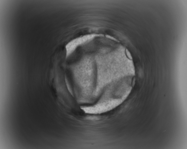X0000087620914200705251959