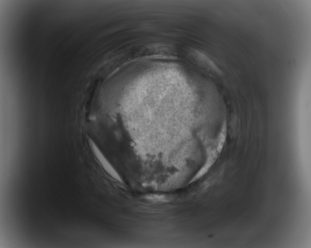 X0000087620917200705251959